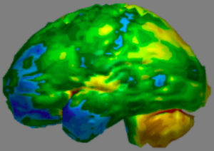CereScan's imaging software